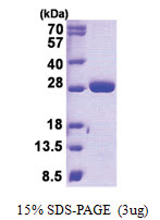 MOB4A (1-216, His-tag) Human Protein