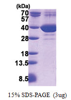 FAM49B (1-324, His-tag) Human Protein