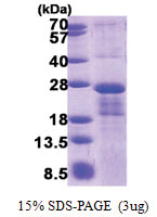 MRI / C7orf49 (1-157, His-tag) Human Protein MRI / C7orf49 (1-157, His-tag) Human Protein