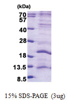 LAGE3 (1-143, His-tag) Human Protein