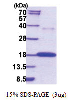 RNASE7 (29-156, His-tag) Human Protein