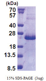 HEN2 (1-135, His-tag) Human Protein