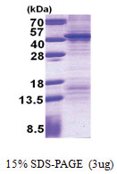 FSBP (1-299, His-tag) Human Protein