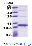 Streptavidin (37-159, His-tag) Human Protein