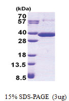 RARRES1 (43-294, His-tag) Human Protein