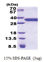 YAE1D1 (1-226, His-tag) Human Protein