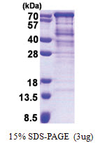 ASPSCR1 (1-553, His-tag) Human Protein