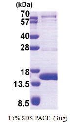 TEN1 (1-123, His-tag) Human Protein