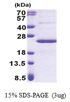 PPP1R11 (1-126, His-tag) Human Protein