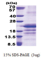 GatC-like (1-136, His-tag) Human Protein