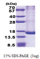 TRAPPC2L (1-139, His-tag) Human Protein