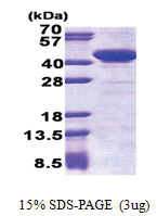 STBD1 / Genethonin-1 (24-358, His-tag) Human Protein