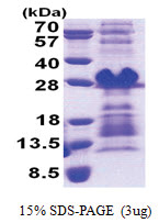 PRH1 / PRH2 (17-122, His-tag) Human Protein