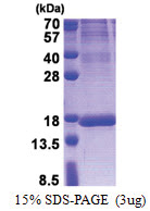 ISOC2 (59-205, His-tag) Human Protein