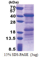 HEPACAM2 (32-351, His-tag) Human Protein