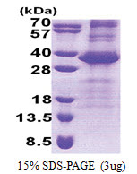 NEURL2 (1-285, His-tag) Human Protein