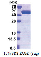 TBC1D13 (1-400, His-tag) Human Protein