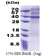 MRPS2 (1-296, His-tag) Human Protein