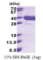 NFKBID / IKBNS (1-313, His-tag) Human Protein