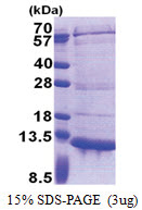 PET117 (23-81, His-tag) Human Protein