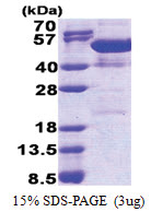 NAP1L4 (1-375, His-tag) Human Protein