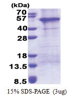 AP1AR (1-302, His-tag) Human Protein