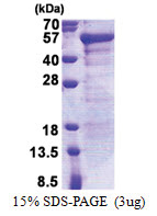 JSRP1 (1-331, His-tag) Human Protein