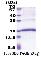 KHDC1L (1-128, His-tag) Human Protein KHDC1L (1-128, His-tag) Human Protein