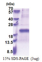TXNRD3NB (1-133, His-tag) Human Protein TXNRD3NB (1-133, His-tag) Human Protein