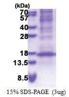 DEFB116 (24-102, His-tag) Human Protein