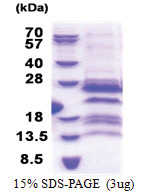 GAGE7 (1-117, His-tag) Human Protein