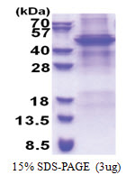 APOBEC4 (1-367, His-tag) Human Protein