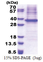 NipSnap1 (1-284, His-tag) Human Protein