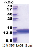 MTCP1 (1-107, His-tag) Human Protein