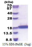 TCL1B / TCL1 (1-128, His-tag) Human Protein