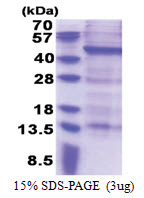 MAGE-B10 (1-347, His-tag) Human Protein