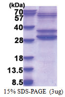 PMF1-BGLAP (1-211, His-tag) Human Protein