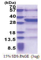 KCTD4 (1-259, His-tag) Human Protein