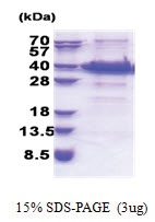 FANK1 (His-tag) Human Protein