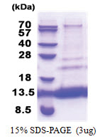 MTCP1 (1-68, His-tag) Human Protein