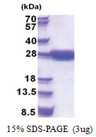 STARD5 (1-213, His-tag) Human Protein