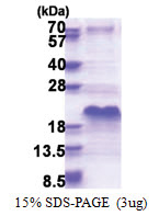 SHFM1 (1-70, His-tag) Human Protein