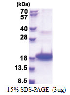 DEFB118 (21-123, His-tag) Human Protein