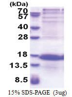 PCP4L1 (1-68, His-tag) Human Protein