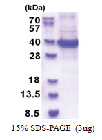 RBM11 (1-281, His-tag) Human Protein