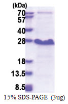 NDFIP1 (1-116, His-tag) Human Protein