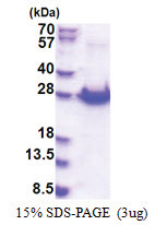 PCMTD1 (1-220, His-tag) Human Protein