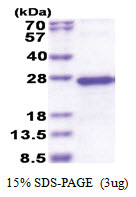 TGIF2LY (1-185, His-tag) Human Protein TGIF2LY (1-185, His-tag) Human Protein