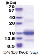 CNPY1 (1-92, His-tag) Human Protein