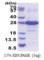Iodotyrosine dehalogenase 1 / IYD (24-214, His-tag) Human Protein